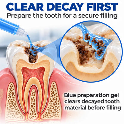 Dr.Fachmer® DentRestore Tooth Repair & Filling System 🍀