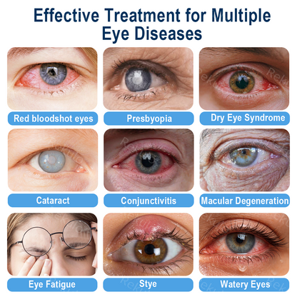 Rekulo® OptiMist Eye Spray✅For dry eyes, blurry vision, eye strain, presbyopia, and cataracts 🍁 up