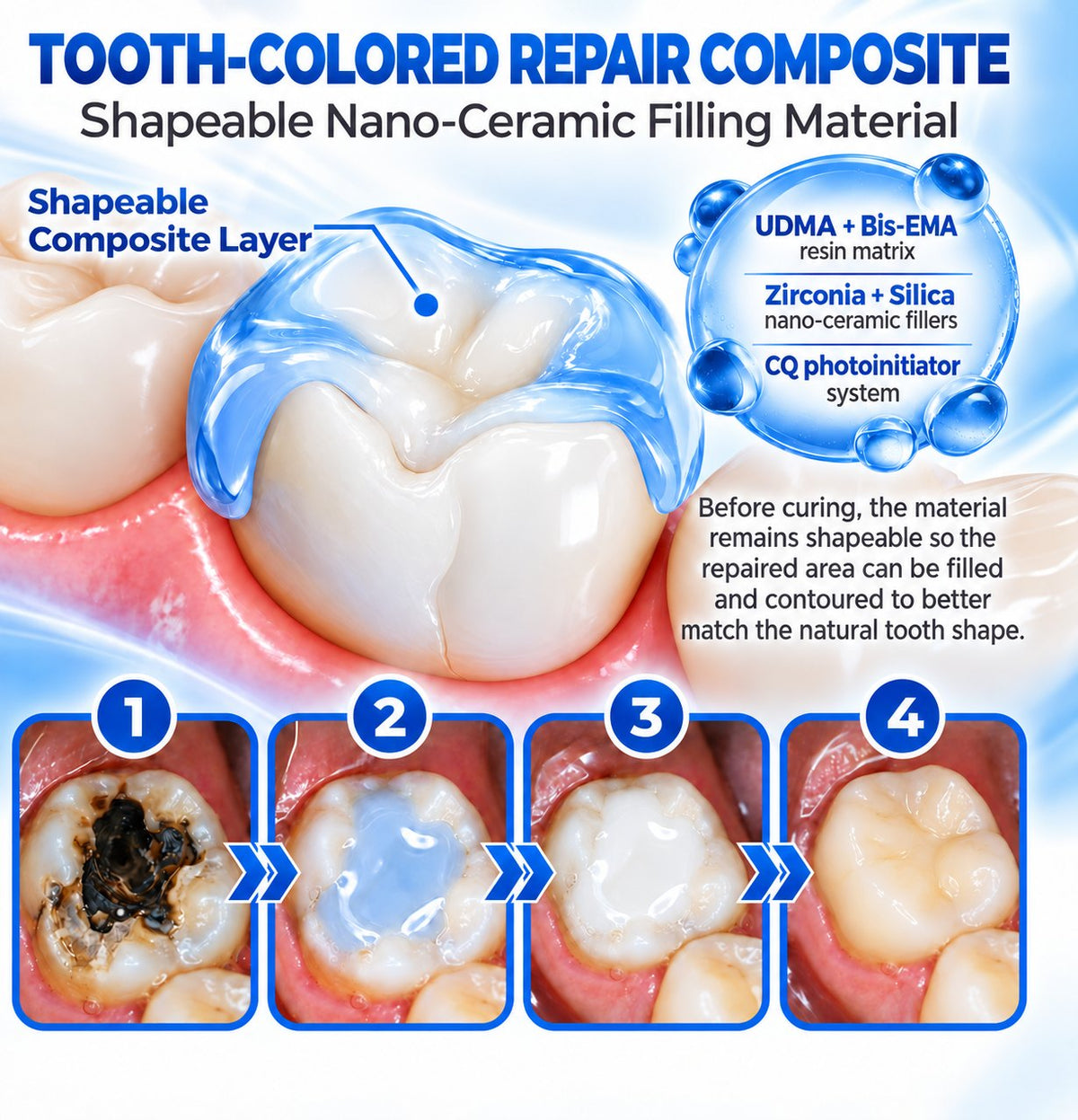 Dr.Fachmer® DentRestore Tooth Repair & Filling System 🍀