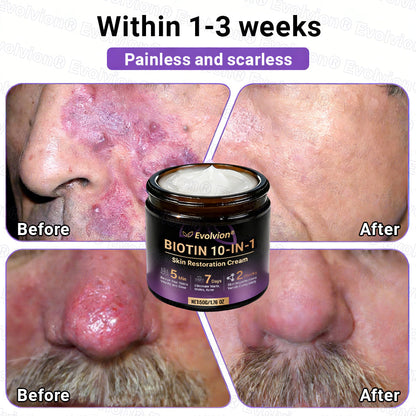 Made and Shipped from Canada ✨Evolvion® Biotin 10-in-1 Skin Restoration Cream🍁