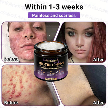 Made and Shipped from Canada ✨Evolvion® Biotin 10-in-1 Skin Restoration Cream🍁