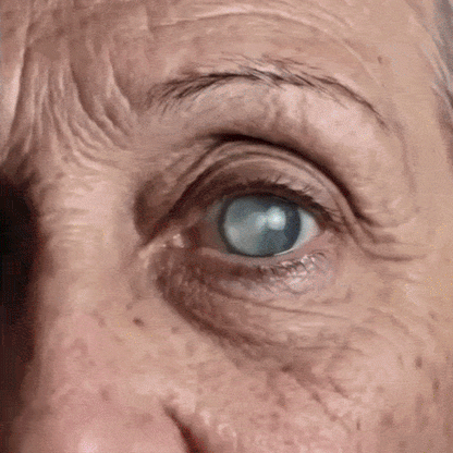 Rekulo® OptiMist Eye Spray✅For dry eyes, blurry vision, eye strain, presbyopia, and cataracts 🍁 up