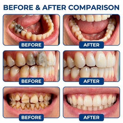 Dr.Fachmer® DentRestore Tooth Repair & Filling System 🍀