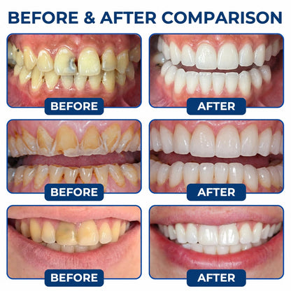 Dr.Fachmer® DentRestore Tooth Repair & Filling System 🍀
